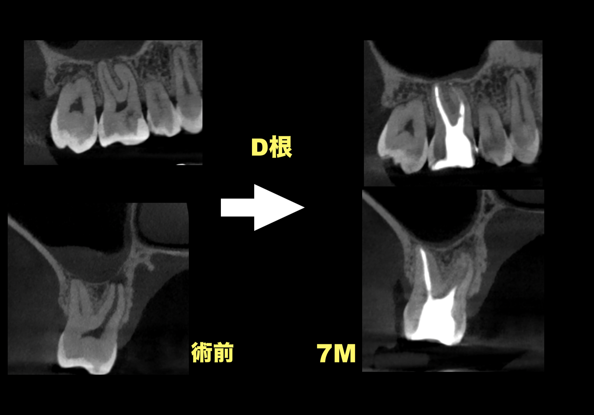 ここから７ヶ月が経過した