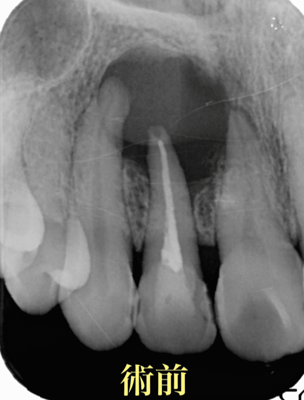 治療前
