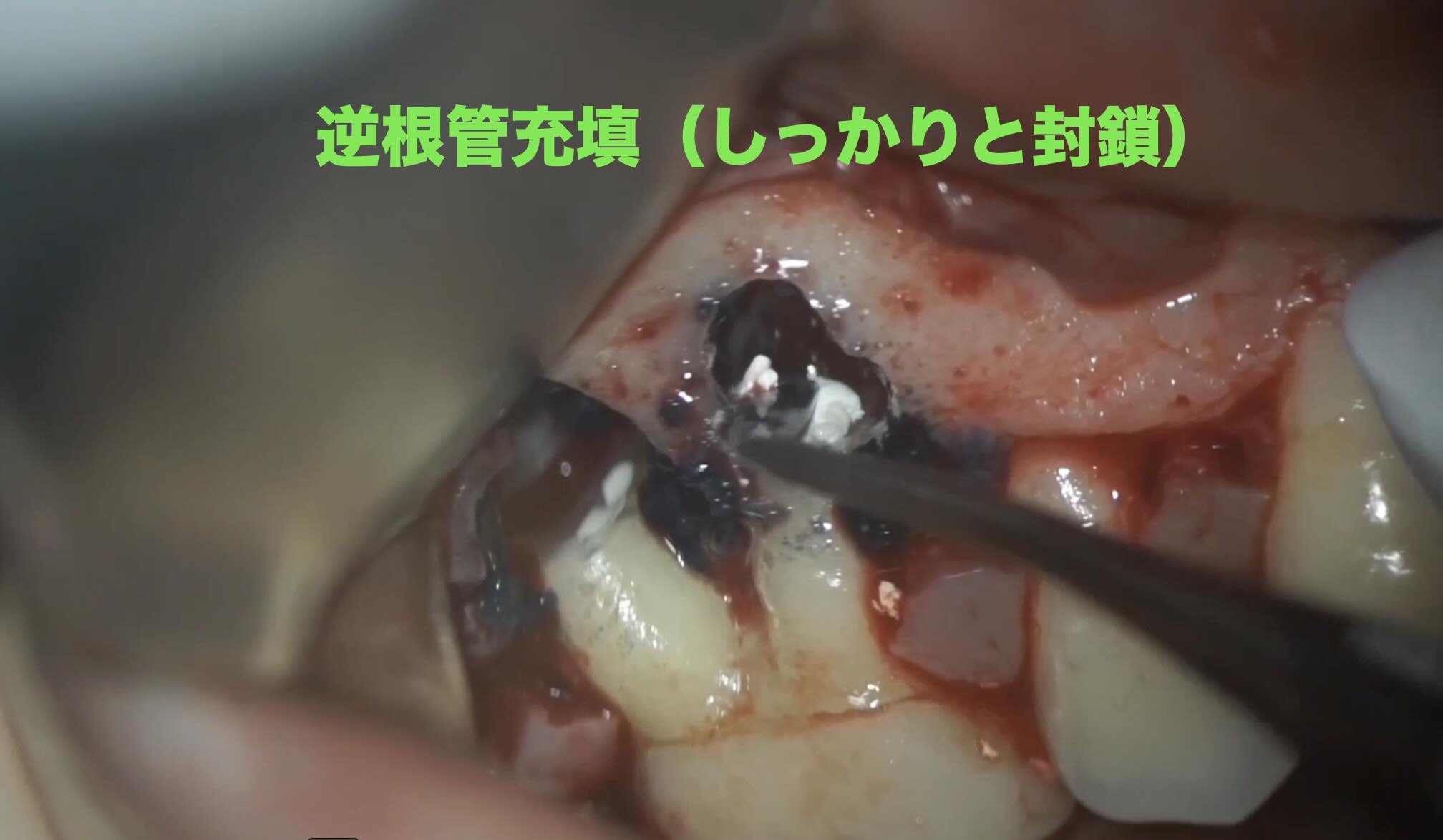 3年後の経過報告