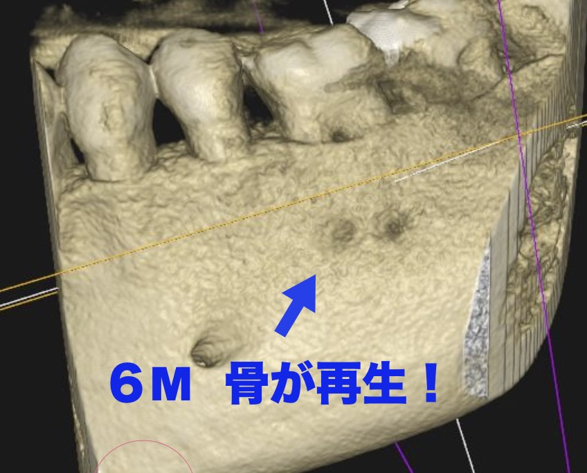 治療後